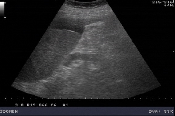 MSK Sonographie